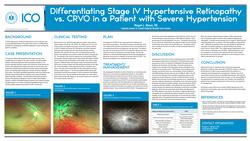 Differentiating Stage IV Hypertensive vs. CRVO in a Patient with Severe HypertensionRetinopathy